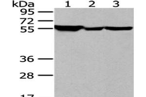 Western Blot analysis of Hela, K562 and NIH/3T3 cell using FYN Polyclonal Antibody at dilution of 1/200 (FYN antibody)