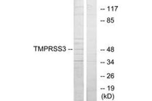 Western blot analysis of extracts from HuvEc cells, using TMPRSS3 Antibody. (TMPRSS3 antibody  (AA 405-454))