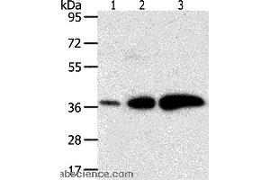 Western blot analysis of Human liver cancer and breast infiltrative duct tissue, human fetal brain tissue, using AKR1C1 Polyclonal Antibody at dilution of 1:500