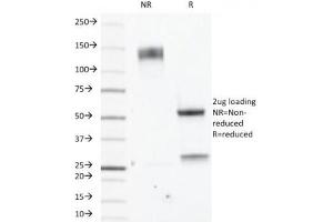 SDS-PAGE Analysis of Purified, BSA-Free Estrogen Receptor beta Antibody (clone ERb455). (ESR2 antibody  (C-Term))