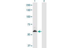 Western Blot analysis of PDHX expression in transfected 293T cell line by PDHX MaxPab polyclonal antibody.