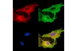 anti-TBC1 Domain Family, Member 12 (TBC1D12) antibody
