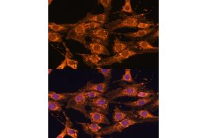Immunofluorescence analysis of C6 cells using UBQLNL antibody (ABIN7271125) at dilution of 1:100. (UBQLNL antibody  (AA 176-475))