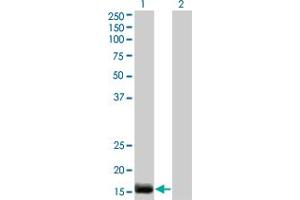 Western Blot analysis of EDN2 expression in transfected 293T cell line by EDN2 monoclonal antibody (M01), clone 3B4-1C5. (Endothelin 2 antibody  (AA 1-178))