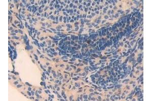 Detection of MYL3 in Mouse Ovary Tissue using Polyclonal Antibody to Myosin Light Chain 3, Alkali, Ventricular, Slow Skeletal (MYL3)