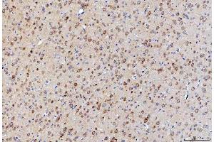 IHC analysis of LNPEP using anti-LNPEP antibody (ABIN7600279). (LNPEP antibody  (AA 17-994))