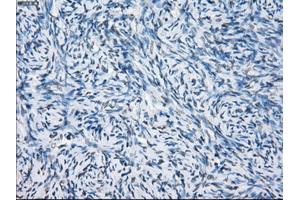 Immunohistochemical staining of paraffin-embedded colon tissue using anti-FCGR2A mouse monoclonal antibody.