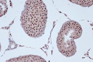 Immunohistochemistry of paraffin-embedded rat testis using KIF4A Rabbit mAb (ABIN7268134) at dilution of 1:100 (40x lens). (KIF4A antibody)
