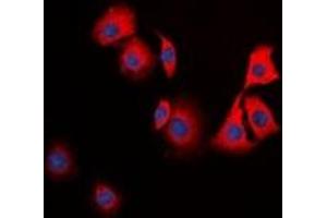Immunofluorescent analysis of TPH1 staining in HuvEc cells. (Tryptophan Hydroxylase 1 antibody)