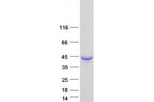 Western Blotting (WB) image for Aldolase A, Fructose-Bisphosphate (ALDOA) (Transcript Variant 4) protein (Myc-DYKDDDDK Tag) (ABIN2714557)