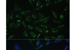 Immunofluorescence analysis of U-2 OS cells using HCCS Polyclonal Antibody at dilution of 1:100 (40x lens). (HCCS antibody)