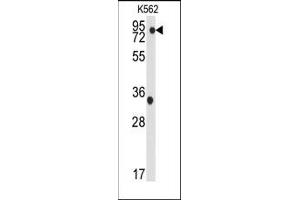 Image no. 1 for anti-TANK-Binding Kinase 1 (TBK1) (Ser172) antibody (ABIN360254)