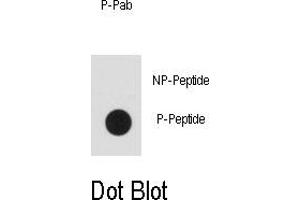 Image no. 1 for anti-Insulin Receptor Substrate 2 (IRS2) (pTyr978) antibody (ABIN358522) (IRS2 antibody  (pTyr978))