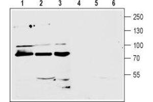 Western blot analysis of mouse (lanes 1 and 4) and rat (lanes 2 and 5) brain membranes and human CCF-STTGI astrocytoma (lanes 3 and 6) cell line lysate (1:200): - 1-3. (GRM7 antibody  (Extracellular, N-Term))