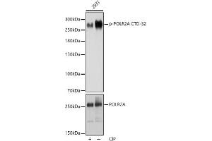 Western blot analysis of extracts of 293T cells, using Phospho-POLR2A CTD-S2 antibody (ABIN6135286, ABIN6136194, ABIN6136195 and ABIN6225651) at 1:1000 dilution or POLR2A antibody (ABIN3022932, ABIN3022933, ABIN3022934 and ABIN6219303). (POLR2A/RPB1 antibody  (pSer2))