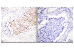 Immunohistochemistry (IHC) image for anti-Ubiquitin Protein Ligase E3 Component N-Recognin 5 (UBR5) (N-Term) antibody (ABIN1848820) (UBR5 antibody  (N-Term))