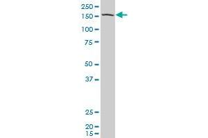 PCDH11Y polyclonal antibody (A01), Lot # 061025JCS1 Western Blot analysis of PCDH11Y expression in 293 . (PCDH11Y antibody  (AA 57-165))