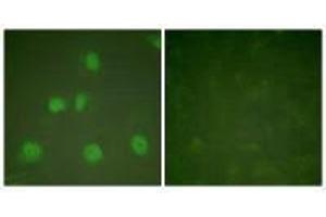Immunofluorescence analysis of HeLa cells, treated with PMA (125 ng/mL, 30 mins), using Cullin 1 antibody. (Cullin 1 antibody)