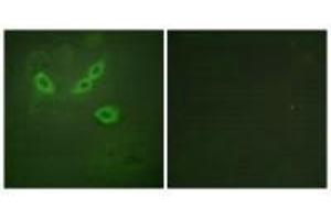 Immunofluorescence analysis of HeLa cells, using TUSC5 antibody. (TUSC5 antibody)