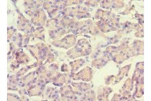 Immunohistochemistry of paraffin-embedded human pancreatic tissue using ABIN7169536 at dilution of 1:100 (ACADS antibody  (AA 1-260))