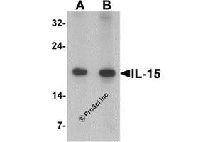 Western Blotting (WB) image for anti-Interleukin 15 (IL15) antibody (ABIN1077441) (IL-15 antibody)