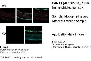 Immunohistochemistry (IHC) image for anti-Pannexin 1 (PANX1) (Middle Region) antibody (ABIN2775573) (PANX1 antibody  (Middle Region))