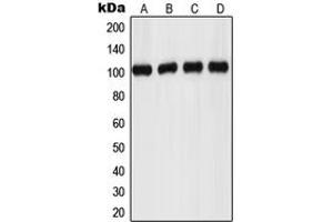 Western blot analysis of GPR110 expression in MCF7 (A), HeLa (B), mouse kidney (C), rat brain (D) whole cell lysates. (G Protein-Coupled Receptor 110 antibody  (C-Term))