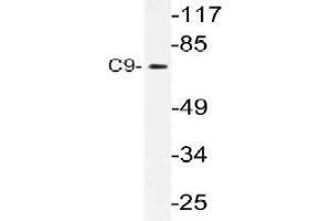 Western blot (WB) analysis of C9 antibody in extracts from COLO cells. (C9 antibody)