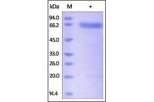 Human PH20, His Tag on SDS-PAGE under reducing (R) condition. (SPAM1 Protein (AA 36-482) (His tag))