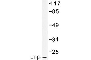 Image no. 1 for anti-Lymphotoxin-alpha (LTA) antibody (ABIN272216) (LTA antibody)