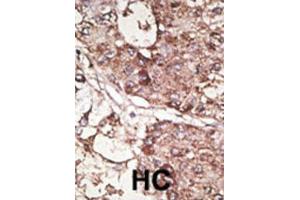 Immunohistochemistry (IHC) image for anti-CD90 (THY1) antibody (ABIN3001433)