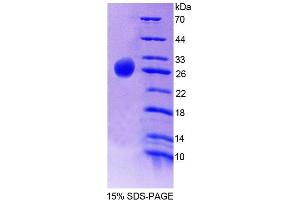 SDS-PAGE analysis of Human CSN1 Protein. (Casein alpha S1 Protein (CSN1S1))