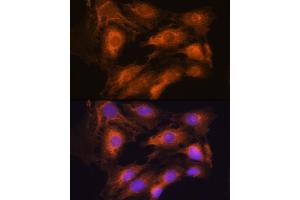 Immunofluorescence analysis of C6 cells using  Rabbit pAb (ABIN7265658) at dilution of 1:100. (ARCN1 antibody  (AA 212-511))