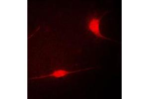 Immunofluorescent analysis of LIMK1 staining in COLO205 cells. (LIM Domain Kinase 1 antibody  (Center))