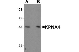 Western Blotting (WB) image for anti-Karyopherin (Importin) alpha 4 (KPNA4) (N-Term) antibody (ABIN1031431)