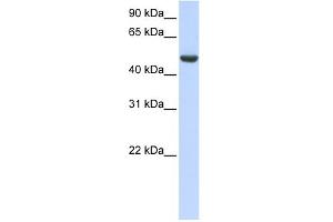 WB Suggested Anti-SPATA17 Antibody Titration: 0. (SPATA17 antibody  (C-Term))
