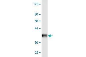 Western Blot detection against Immunogen (34. (Caveolin 3 antibody  (AA 1-83))