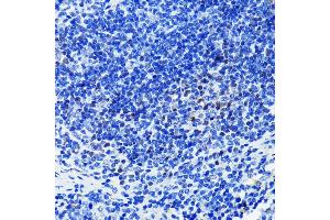 Immunohistochemistry of paraffin-embedded mouse spleen using P antibody  at dilution of 1:100 (40x lens). (PARP1 antibody)