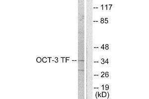 Western Blotting (WB) image for anti-POU Class 5 Homeobox 1 (POU5F1) (Internal Region) antibody (ABIN1848708)