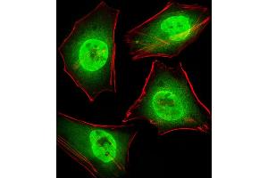 Fluorescent image of Hela cells stained with GTF2I Antibody .