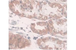DAB staining on IHC-P Samples:Human Stomach Tissue (SLC40A1 antibody  (AA 127-321))