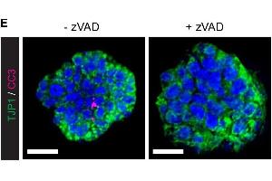 SMG organoids were treated with 50μM z-VAD-FMK, a pan-caspase inhibitor, for 2 days, followed by whole-mount immunostaining with antibodies against CC3 (cleaved caspase-3) and TJP1 (ZO-1).