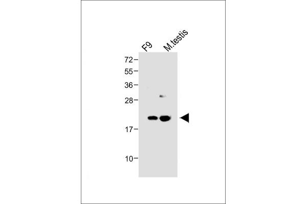 VHL Antikörper  (N-Term)