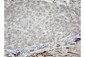 Image no. 2 for anti-Coagulation Factor XIII, A1 Polypeptide (F13A1) antibody (ABIN1498152)