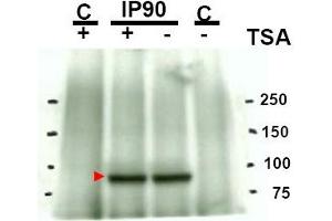 Image no. 1 for anti-Heat Shock Protein 90kDa alpha (Cytosolic), Class A Member 1 (HSP90AA1) (acLys294) antibody (ABIN401378) (HSP90AA1 antibody  (acLys294))