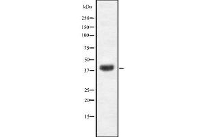 Western blot analysis of EGR3 using K562 whole cell lysates (EGR3 antibody  (Internal Region))