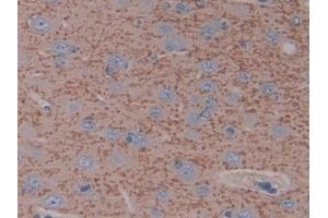 Detection of ICAM1 in Rat Cerebrum Tissue using Polyclonal Antibody to Intercellular Adhesion Molecule 1 (ICAM1) (ICAM1 antibody  (AA 102-306))