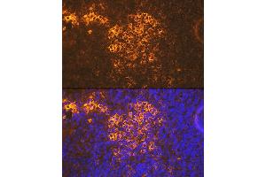 Immunofluorescence analysis of mouse spleen using CXCR5 Rabbit mAb (ABIN7266321) at dilution of 1:100 (40x lens). (CXCR5 antibody)