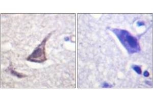 Immunohistochemistry analysis of paraffin-embedded human brain tissue, using C/EBP-epsilon (Ab-74) Antibody. (CEBPE antibody  (AA 40-89))