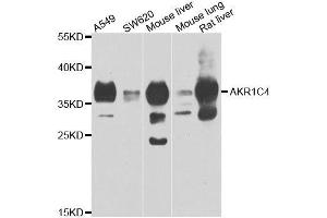 Western blot analysis of extracts of various cell lines, using AKR1C4 antibody. (AKR1C4 antibody  (AA 1-323))